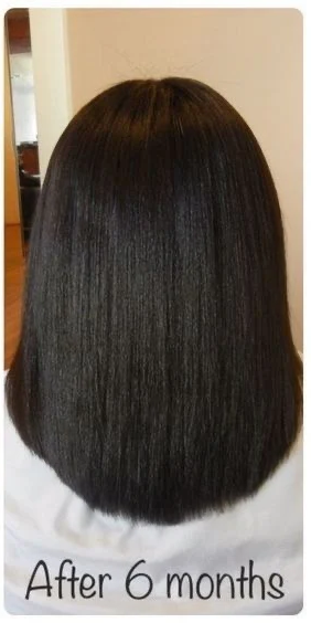 Hair Growth kit